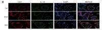 CK7 Monoclonal Antibody(12D7)