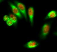 CK7 Monoclonal Antibody(12D7)