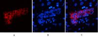 CK7 Monoclonal Antibody(12D7)