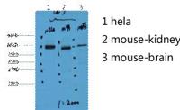 CK7 Monoclonal Antibody(12D7)