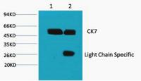 CK7 Monoclonal Antibody(12D7)