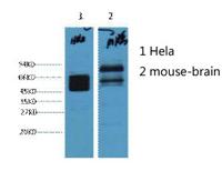 CK8 Monoclonal Antibody(8G8)