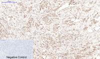 Cleaved PARP Monoclonal Antibody(Mix)