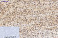 LC3A mouse Monoclonal Antibody(5G10)