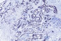 E-Cadherin (ABT181) mouse mAb