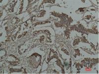 HSP27 Monoclonal Antibody(Mix-mA)