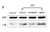 α-SMA Monoclonal Antibody(1E12)