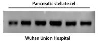 α-SMA Monoclonal Antibody(1E12)