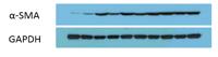 α-SMA Monoclonal Antibody(1E12)