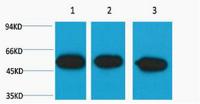 β III tubulin Monoclonal Antibody(Mix)