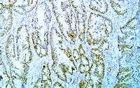 MutL Protein Homolog 1(MLH1) (ABT-MLH1) mouse mAb