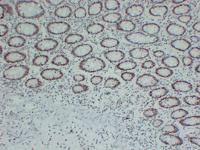 MutL Protein Homolog 1(MLH1) (ABT-MLH1) mouse mAb