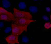 His-Tag Monoclonal Antibody(4E6)