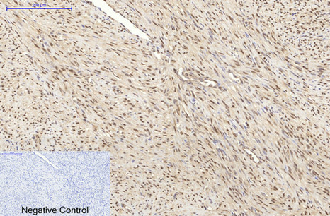 HSP70 Monoclonal Antibody(3G10)