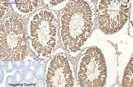 HSP70 Monoclonal Antibody(3G10)