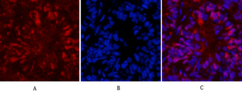 HSP70 Monoclonal Antibody(3G10)