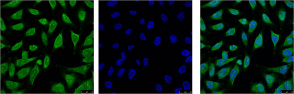 HSP70 Monoclonal Antibody(3G10)