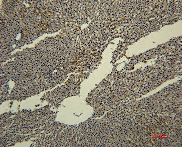 Transferrin Monoclonal Antibody(4B4)