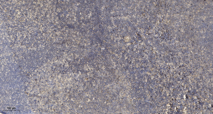 Transferrin Monoclonal Antibody(3G2)
