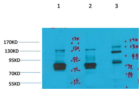 Kv11.3 Polyclonal Antibody