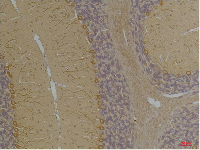 Kv1.8 Polyclonal Antibody