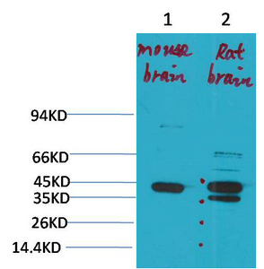 KCNK9 (TASK-3) Polyclonal Antibody