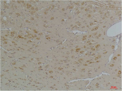 KChIP3 Polyclonal Antibody