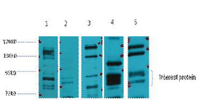 Glucocorticoid receptor Polyclonal Antibody
