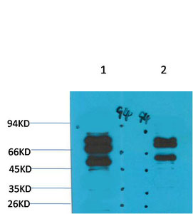 GABA A Receptor γ2 Polyclonal Antibody