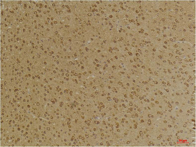 GABA A Receptor γ2 Polyclonal Antibody