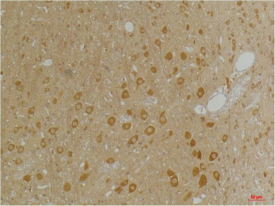 GABA A Receptor α3 Polyclonal Antibody