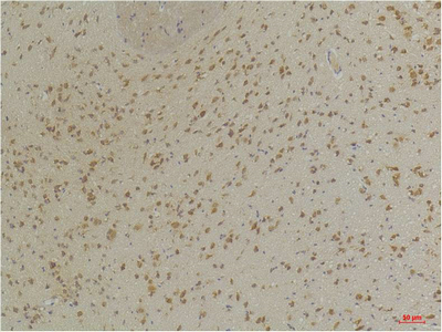 GABA A Receptor α3 Polyclonal Antibody