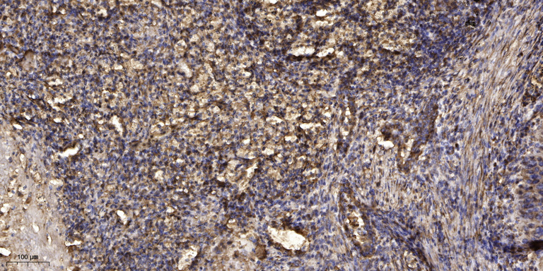 Gab1 Rabbit Polyclonal Antibody