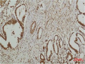 ERK 5 Polyclonal Antibody