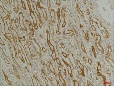 CLIC1 Polyclonal Antibody