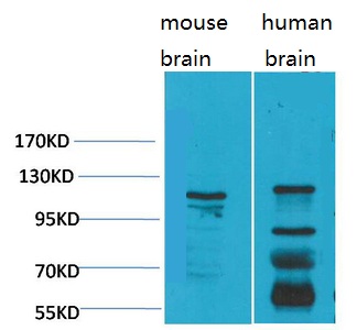 CaVα2δ3 Polyclonal Antibody