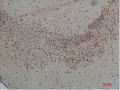 CaVα2δ1 Polyclonal Antibody