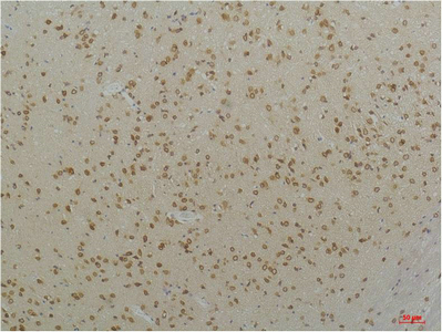Cav1.2 Polyclonal Antibody