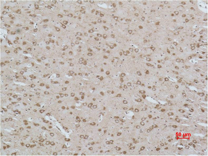 CACNG3 Polyclonal Antibody