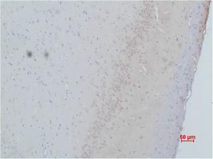 CACNG2 Polyclonal Antibody