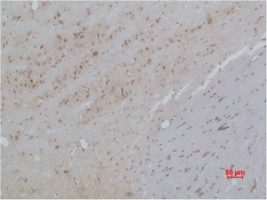 CACNB3 Polyclonal Antibody