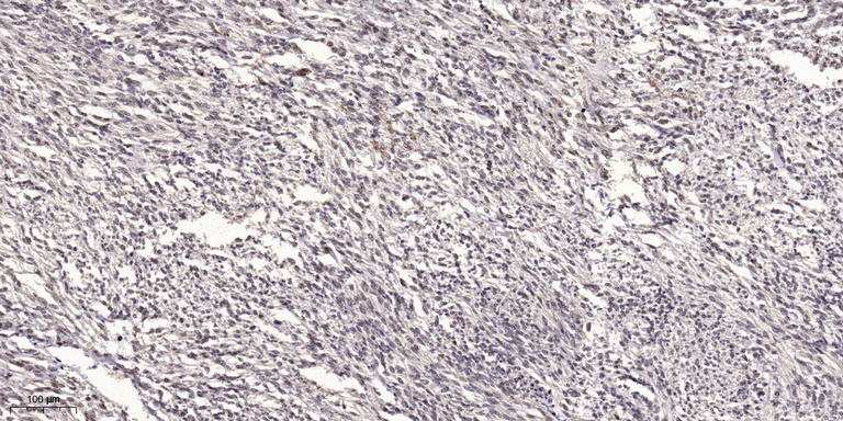 ATG4b Rabbit Polyclonal Antibody