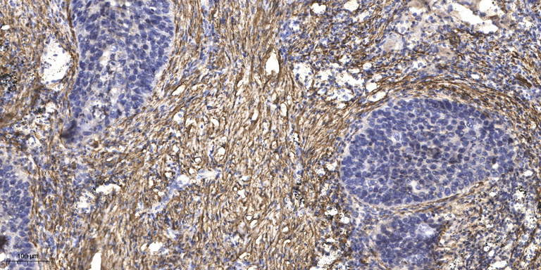 ATG13 Rabbit Polyclonal Antibody