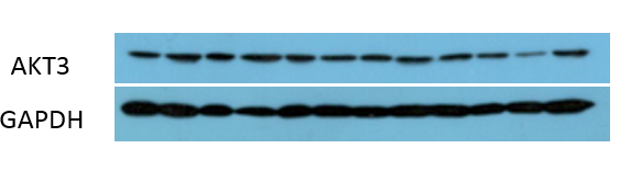Akt3 Polyclonal Antibody