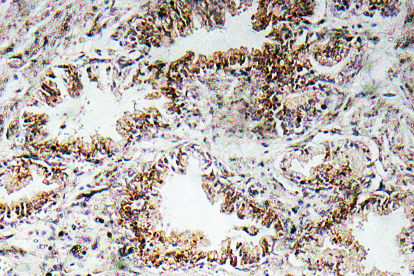 AChRα1 Polyclonal Antibody