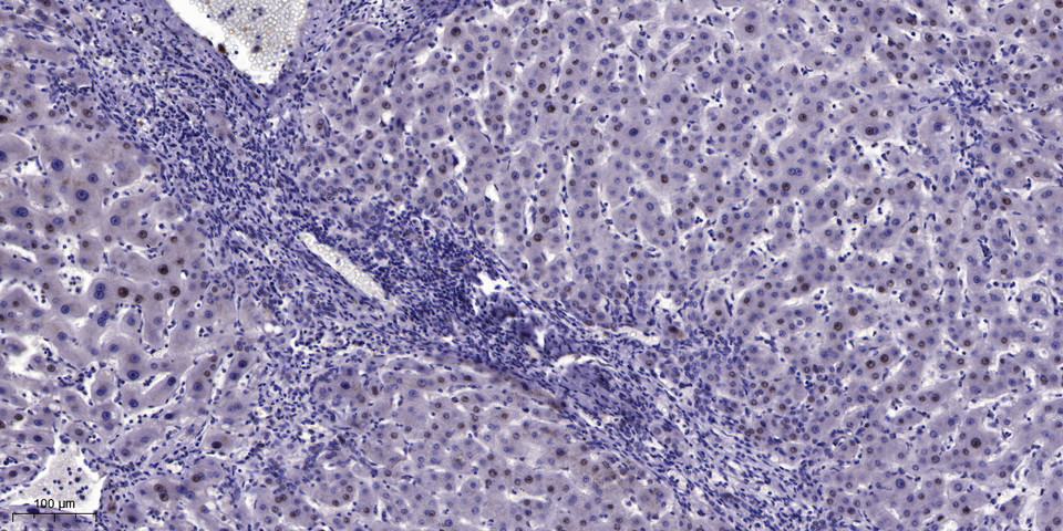 ATF-2 Polyclonal Antibody