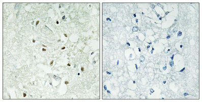 Ku-86 Polyclonal Antibody