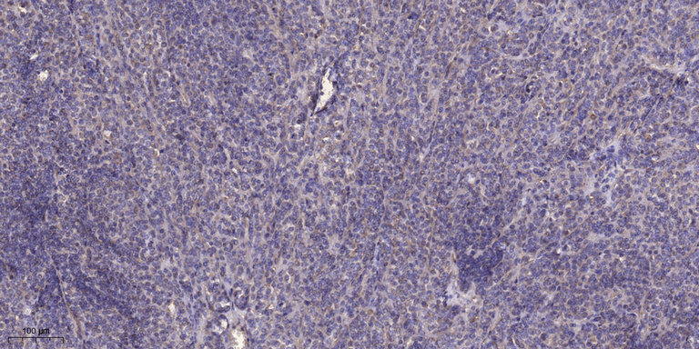 IDHP Polyclonal Antibody