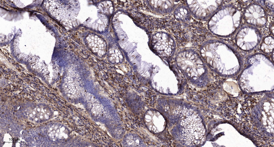 CEAM6 Polyclonal Antibody