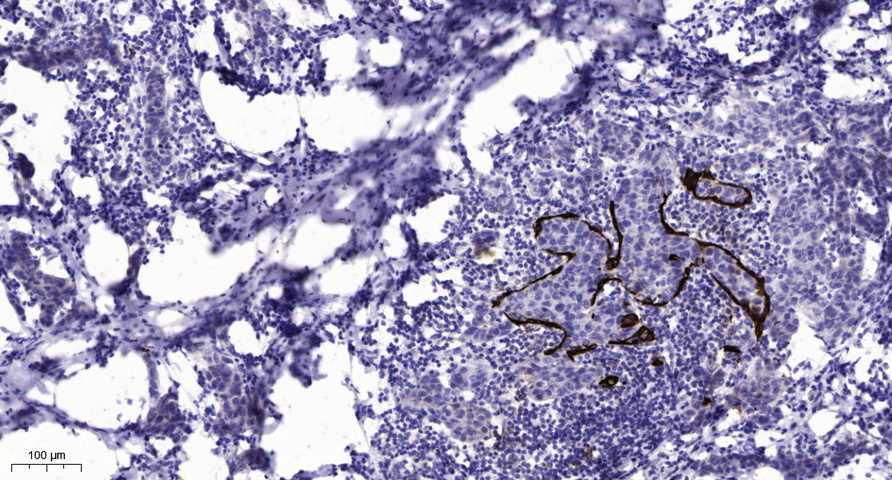 COLQ Polyclonal Antibody